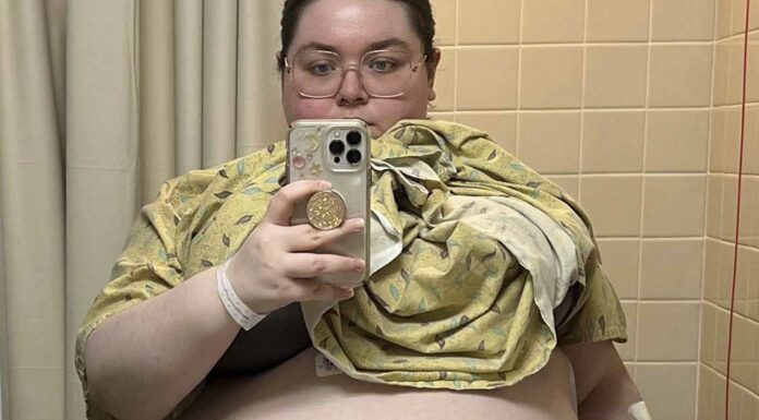 ‘It felt like my organs were being crushed,’ said a 20-year-old woman from Florida after having a 100-pound ovarian cyst