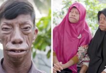 Family with mysterious facial condition are becoming an internet sensation – now they’re inspiring millions worldwide