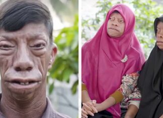 Family with mysterious facial condition are becoming an internet sensation – now they’re inspiring millions worldwide