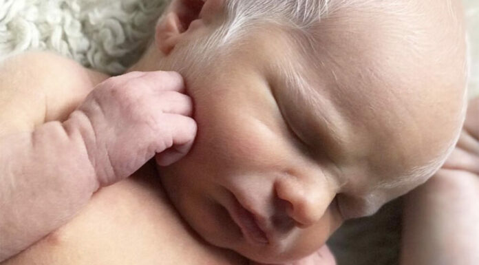 Baby mocked for having white hair – but wait until you see how he looks years later