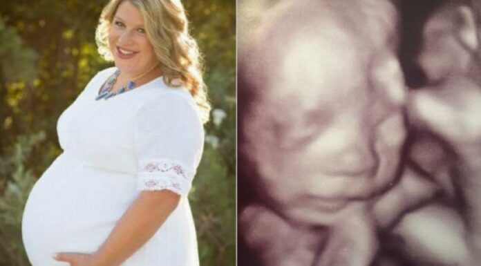 After her husband dies, she finds out she’s pregnant – then she sees the jaw-dropping ultrasound