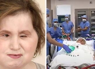 The amazing story of Katie Stubblefield: She became the youngest person to receive a face transplant