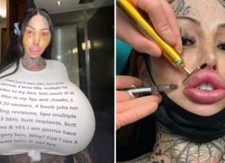 Woman who wants to become a ‘forest elf’ gets Barbie nose and cat eyes in new extreme procedure