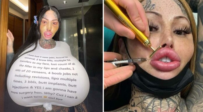 Woman who wants to become a ‘forest elf’ gets Barbie nose and cat eyes in new extreme procedure