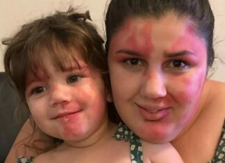 Baby called ‘hideous’ is a gorgeous little girl now