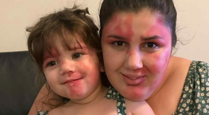 Baby called ‘hideous’ is a gorgeous little girl now