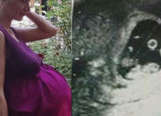 Historic pregnancy leaves everyone in the delivery room speechless