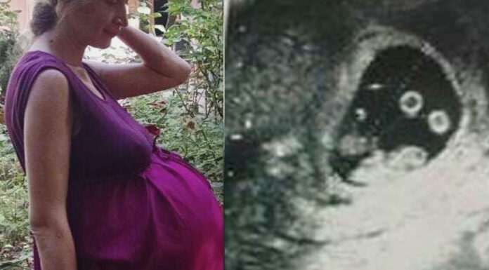 Historic pregnancy leaves everyone in the delivery room speechless