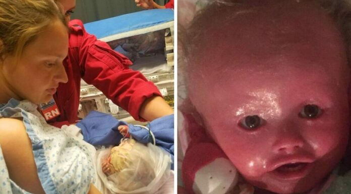 A baby girl who ‘never stops smiling’ is living with a rare skin condition that makes her skin crack