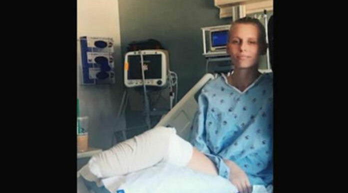 Her legs are amputated after using a common household product – Now she’s warning women everywhere