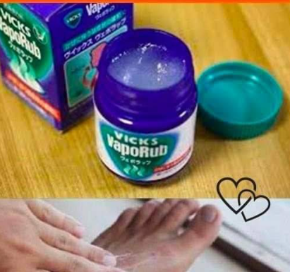Vicks VapoRub: The multipurpose remedy you need