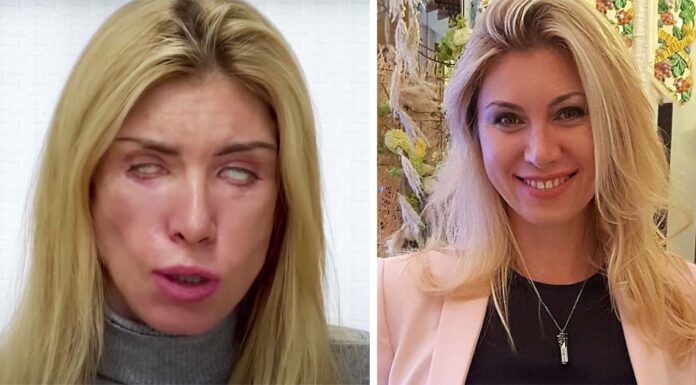 Horror mistake leaves woman unable to close her eyes – read her warning…