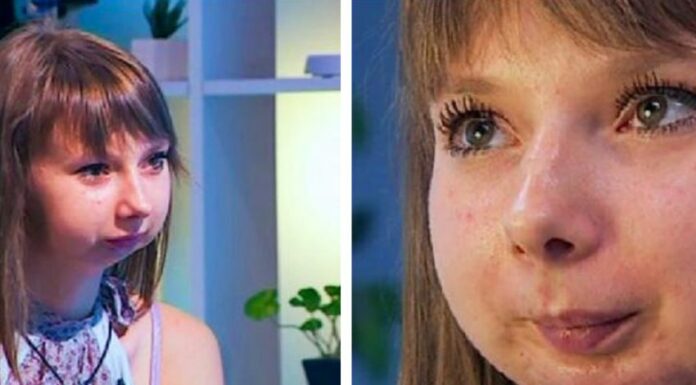What became of the girl whose lower face may have been restored by doctors?