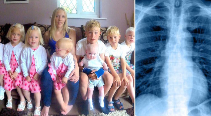 Husband suddenly dies and leaves wife with 8 kids – his hidden disease was overlooked by everyone