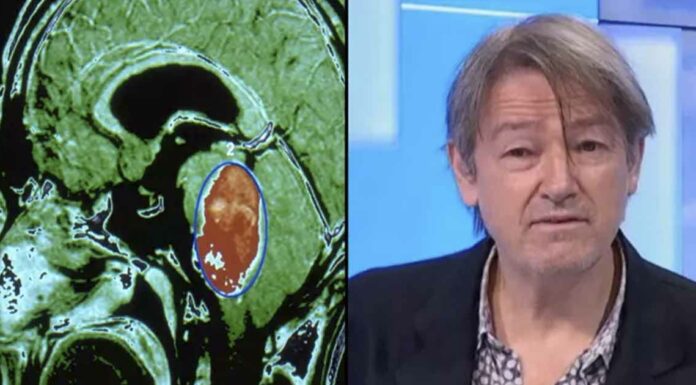In world first: Teenage boy is cured of deadly brain cancer