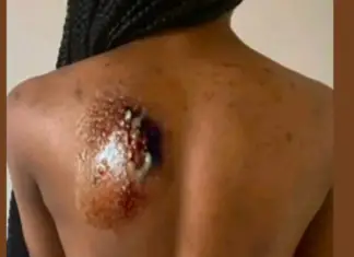 10 warning signs that something isn’t right with your body