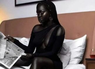 Accepting the Beauty of Self-Love: Nyakim Gatwech’s Moving Story