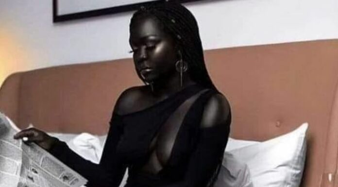 Accepting the Beauty of Self-Love: Nyakim Gatwech’s Moving Story