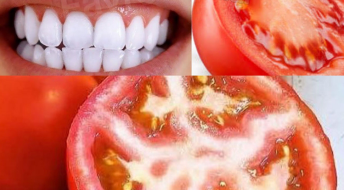 Brighten your smile naturally: Tomato teeth whitening
