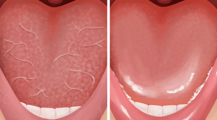 6 Proven Ways to Avoid Bad Breath