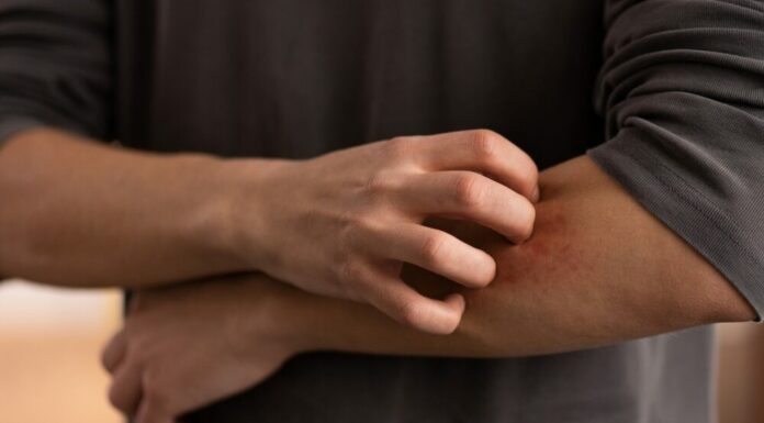 Don’t overlook these small red spots on your arm – They could be important warning signs