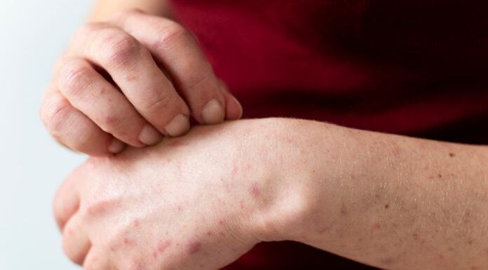 A Mother’s Research Saved Her Son: A Hidden Disease Parents Should Know