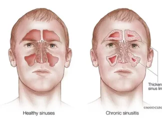 How to Clear Your Sinuses in Seconds with a Simple Self-Massage Technique