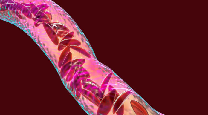 10 Critical Warning Signs of Poor Blood Circulation You Must Know