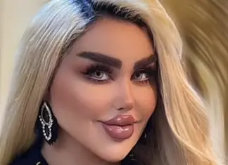 She Had 43 Cosmetic Procedures To Become A Barbie Doll – Critics Say She Looks Like A ‘Zombie’