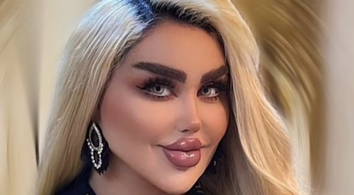 She Had 43 Cosmetic Procedures To Become A Barbie Doll – Critics Say She Looks Like A ‘Zombie’
