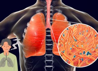 How to Naturally Clear Phlegm and Mucus from Chest and Throat