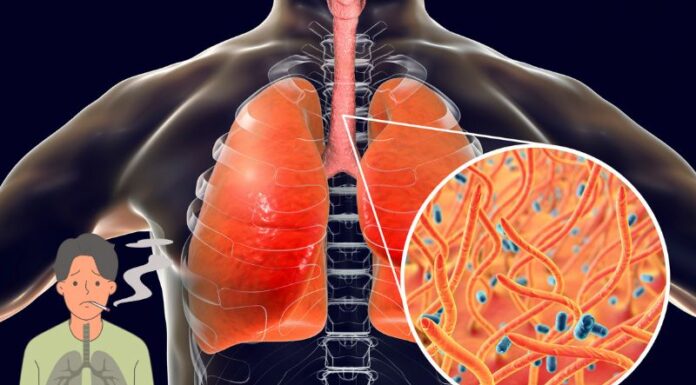 How to Naturally Clear Phlegm and Mucus from Chest and Throat