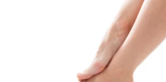 What Your Feet Reveal About Heart Health and Clogged Arteries