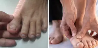 Pharmacist reveals two warning signs of silent killer that you might spot in your feet