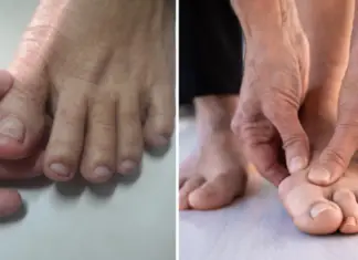 Pharmacist reveals two warning signs of silent killer that you might spot in your feet