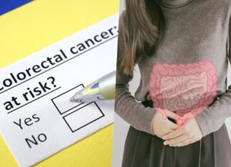 Cancer rates are rising among young people, and scientists suspect a ‘new exposure’ as the cause