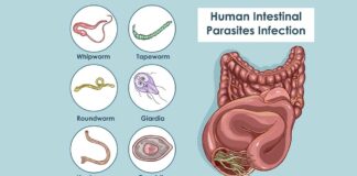 7 signs that you may have intestinal parasites in your body