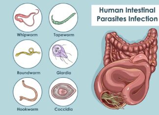 7 signs that you may have intestinal parasites in your body