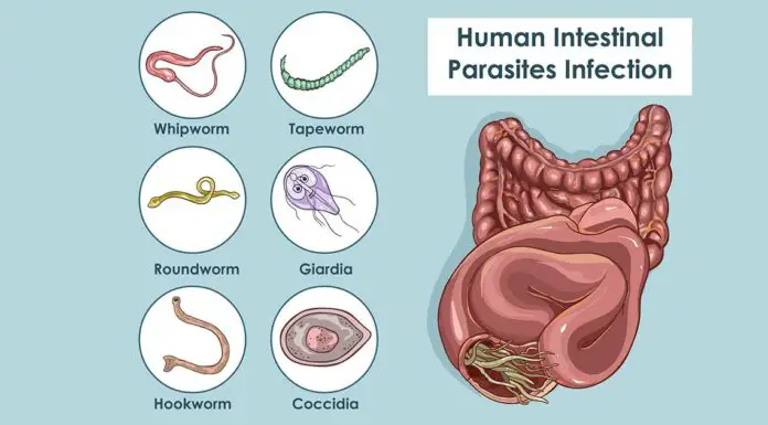 7 signs that you may have intestinal parasites in your body