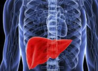 Fatty liver: causes, symptoms, treatments, and natural remedies