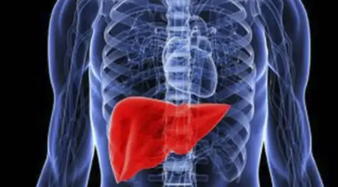 Fatty liver: causes, symptoms, treatments, and natural remedies