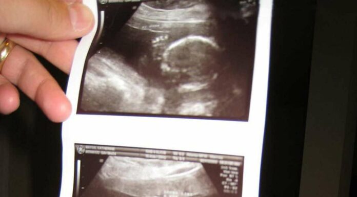 My daughter found a picture in her dad’s suitcase – It made me faint