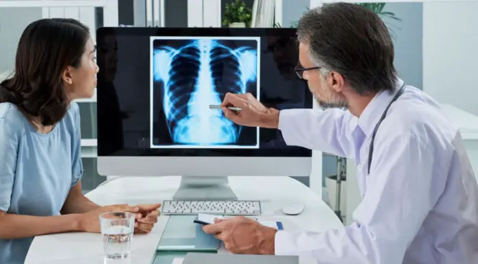 20 early symptoms of lung cancer that shouldn’t be overlooked
