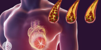 10 beneficial foods for maintaining clean arteries