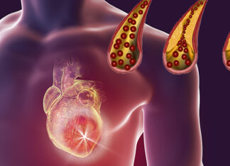 10 beneficial foods for maintaining clean arteries