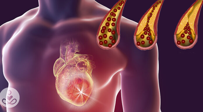 10 beneficial foods for maintaining clean arteries