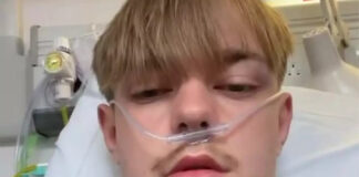 Teenager vaping the equivalent of 50 cigarettes a day receives shocking diagnosis after coughing up ‘pints’ of blood