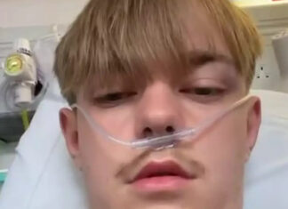 Teenager vaping the equivalent of 50 cigarettes a day receives shocking diagnosis after coughing up ‘pints’ of blood
