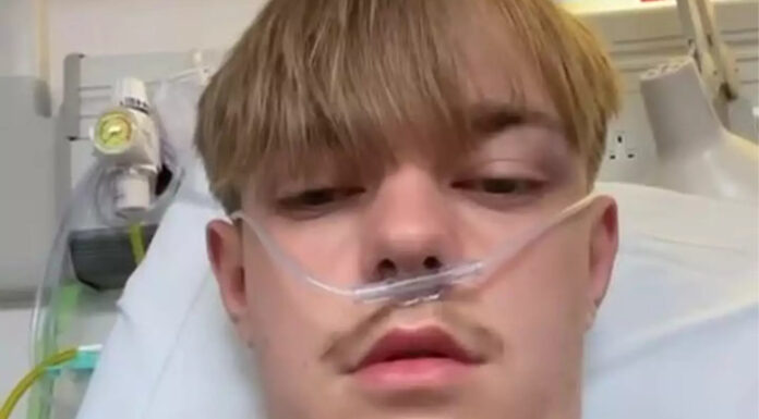 Teenager vaping the equivalent of 50 cigarettes a day receives shocking diagnosis after coughing up ‘pints’ of blood
