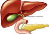Gallbladder removal: what happens next and 3 risks to watch for